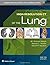 High-Resolution CT of the Lung by Webb, W. Richard, Muller, Nestor L., Naidich, David P (August 11, 2014) Hardcover
