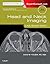 Head and Neck Imaging: Case Review Series, 4e by David M. Yousem MD MBA (2014-12-03)