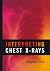 Interpreting Chest X-Rays by Stephen Ellis (2010-04-13)
