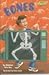Bones