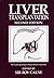 Liver Transplantation