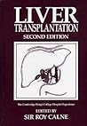 Liver Transplantation