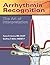 Arrhythmia Recognition: The...
