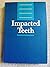 Impacted Teeth