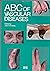 ABC of Vascular Diseases
