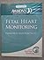 Fetal Heart Monitoring by Eunice Kennedy Shriver