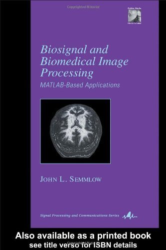 Biosignal and Medical Image Processing (Signal Processing and Communications) 1st Edition by Semmlow, John L. (2004) Hardcover