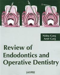 Review of Endodontics Operative Dentistry (Paperback)