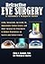 Refractive Eye SurgeryA Consumer's Complete Guide: LASIK, IntraLASIK, Epi-LASIK, CK, Implantable Contact Lenses, and Other Surgical Eye Procedures ... Dependence on Glasses and Contact Lenses by Chris A. Knobbe M.D. (2006-08-25)