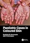 Paediatric Cases in Coloured Skin