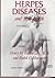 Herpes Diseases and Your Health by Ralph C. Heussner