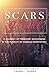 Scars of Grace: A Journey of Freedom, Wholeness & The Pursuit of Finding Your Story by Laura Dudek (2015-12-14)
