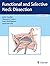 Functional and Selective Neck Dissection