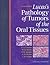 Lucas's Pathology of Tumors...