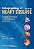 Pathophysiology of Heart Disease (PATHOPHYSIOLOGY OF HEART DISEASE (LILLY)) by Lilly MD, Leonard S. Published by Lippincott Williams & Wilkins 5th (fifth), North American edition (2010) Paperback