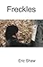 Freckles