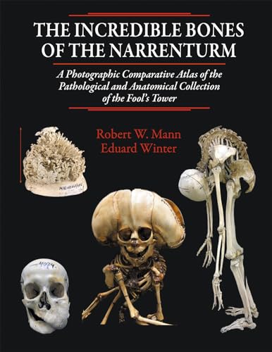 The Incredible Bones of the Narrenturm: Photographic Comparative Atlas of the Pathological and Anatomical Collection of the Fool's Tower (Hardcover)
