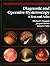Diagnostic and Operative Hysteroscopy: A Text and Atlas