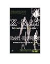 X-Ray by Ray Davies X-Ray by Ray Davies