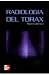 RADIOLOGIA DEL TORAX by Eric J. Stern