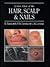 Color Atlas of the Hair, Scalp and Nails