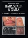 Color Atlas of the Hair, Scalp and Nails