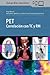 PET- Correlación con TC y RM by Bennet