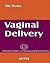 Vaginal Delivery