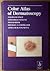 Color Atlas of Dermatoscopy by Wilhelm Stolz (1994-05-03)