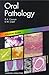 Oral Pathology: Colour Guide, 2e (Colour Guides) by Cawson MD FDSRCS FDSRCPS(Glas) FRCPath FAAOMP Roderick A. Odell FDSRCS MSc PhD FRCPath Edward W (1999-11-19) Paperback