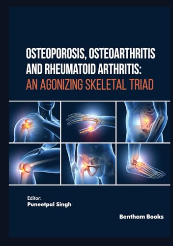 Osteoporosis, Osteoarthritis and Rheumatoid Arthritis: An Agonizing Skeletal Triad (Hardcover)
