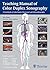 Teaching Manual of Color Duplex Sonography: A workbook on color duplex ultrasound and echocardiography by Matthias Hofer (2010-08-11)