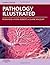 Pathology Illustrated Seventh Edition by Robin Reid (2011-05-10)