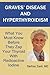 Graves' Disease And Hyperthyroidism: What You Must Know Before They Zap Your Thyroid With Radioactive Iodine by MD, Sarfraz Zaidi (2013-02-23)