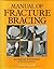 Manual of Fracture Bracing