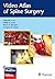 Video Atlas of Spine Surgery