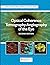 Optical Coherence Tomograph...