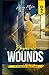 Beyond my Wounds by Mrs. Heidy Mejia Beyond my Wounds by Mrs. Heidy Mejia