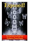 Exposed!: The Crazy Life of an X-ray Tech Working in a Trauma Hospital Book cover for Exposed!: The Crazy Life of an X-ray Tech Working in a Trauma Hospital