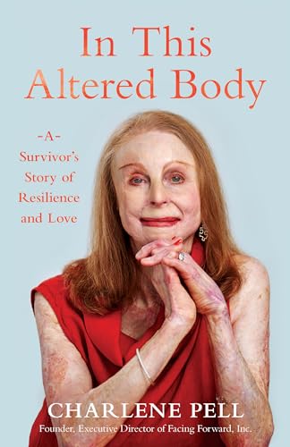 In This Altered Body: A Survivor’s Story of Resilience and Love (Kindle Edition)