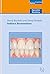 Indirect Restorations (Quin...