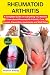 RHEUMATOID ARTHRITIS: A Com...