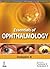 Essentials of Ophthalmology