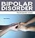 Bipolar Disorder: The Essen...