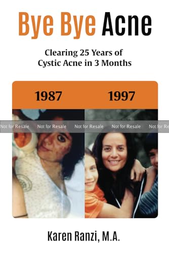 Bye Bye acne: Clearing 25 Years of Cystic Acne in 3 Months (Paperback)