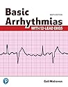 Basic Arrhythmias...