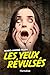 Les Yeux révulsés by Marc-André Pilon