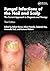 Fungal Infections of the Na...