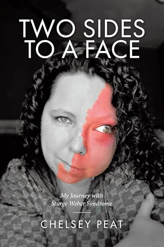 Two Sides to a Face: My Journey with Sturge Weber Syndrome (Kindle Edition)