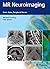 MR Neuroimaging: Brain, Spine, Peripheral Nerves